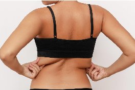 liposuction in bangalore